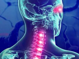 Especialista estima que hasta 2.500 venezolanos padecen Esclerosis Lateral Amiotrófica