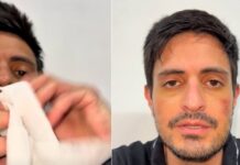 Michelo reaparece golpeado y habla de traidores (VIDEO)
